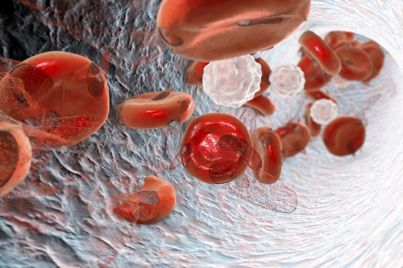 Anemia Objawy Leczenie Przyczyny Czym Jest Anemia I Jak Leczyć Niedokrwistość Aptelinepl 5823