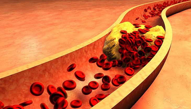 Znalezione obrazy dla zapytania Cholesterol